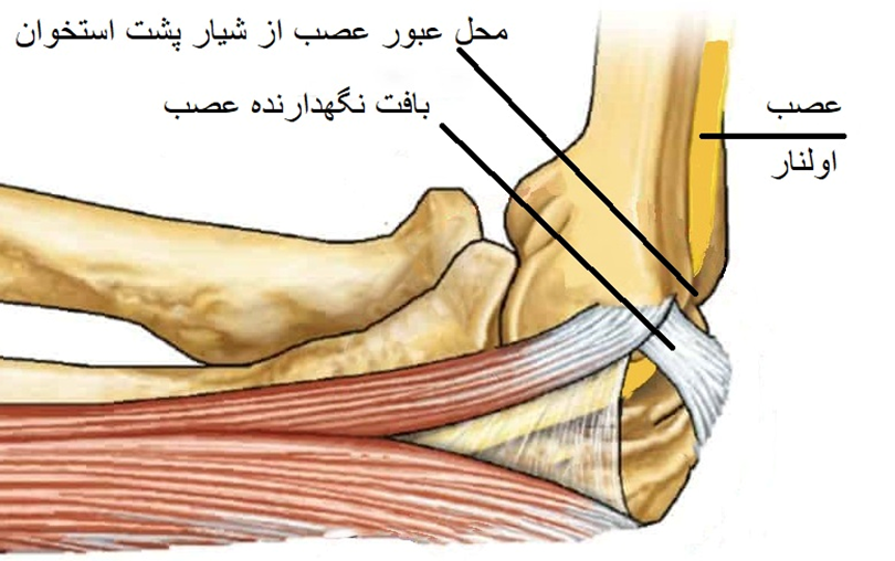 فشار بر عصب اولنار در آرنج
