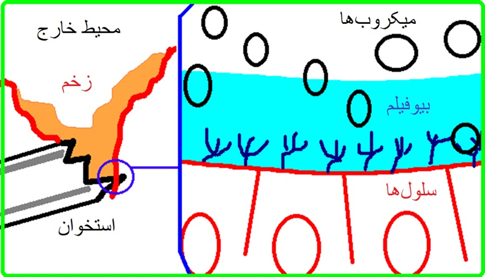 محیط شکستگی باز و بیوفیلم