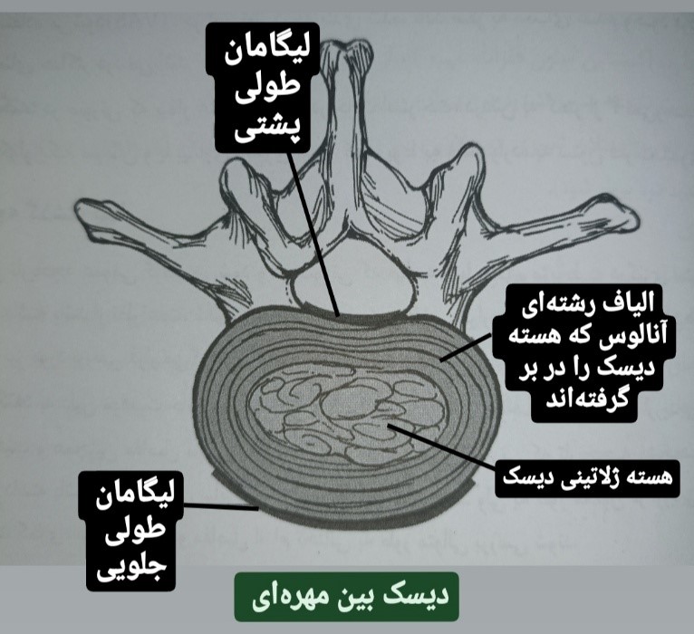 دیسک بین مهره ای - فیزیوتراپی در فتق دیسک
