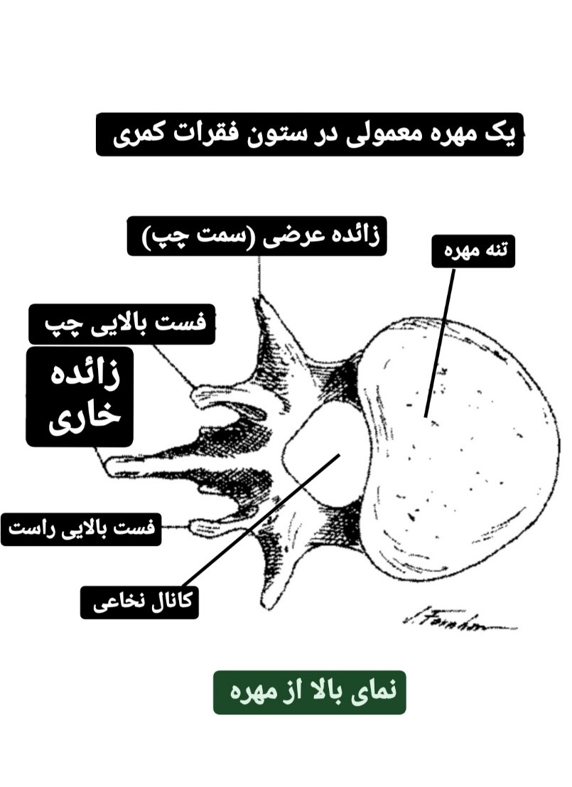 نمای فوقانی مهره کمری - فیزوتراپی فتق دیسک
